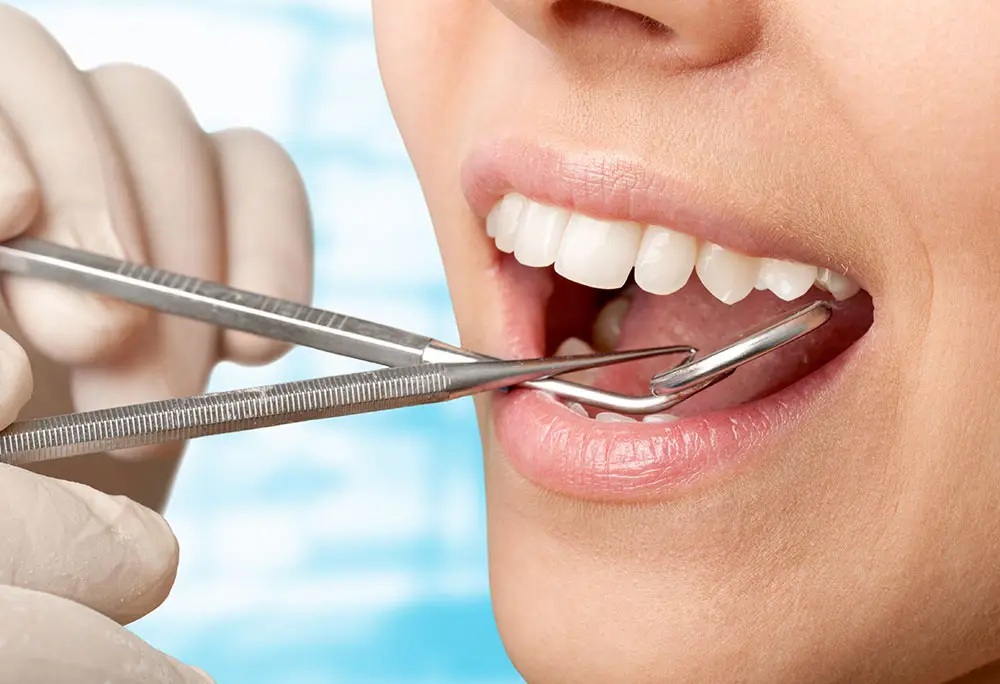 removing tartar from teeth
