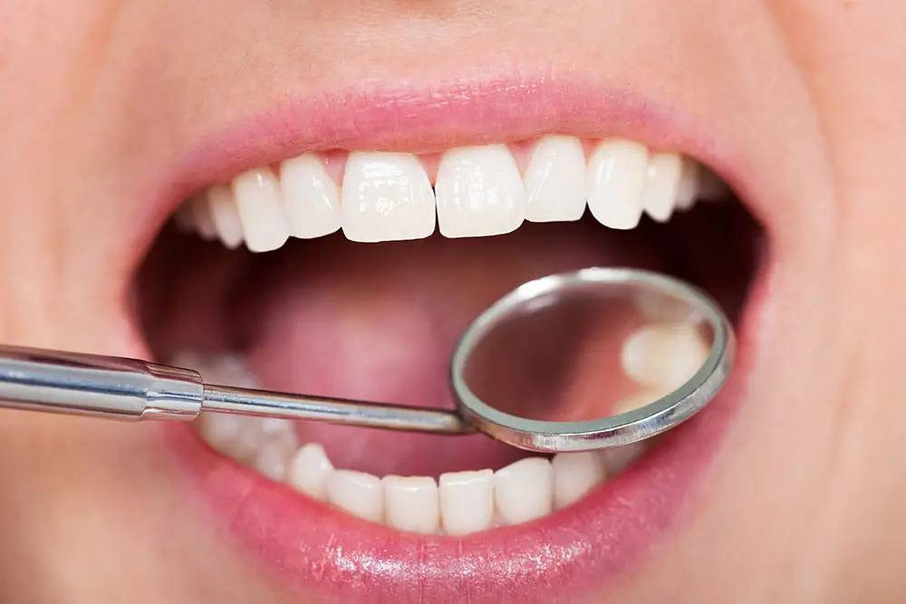 Oral evaluation