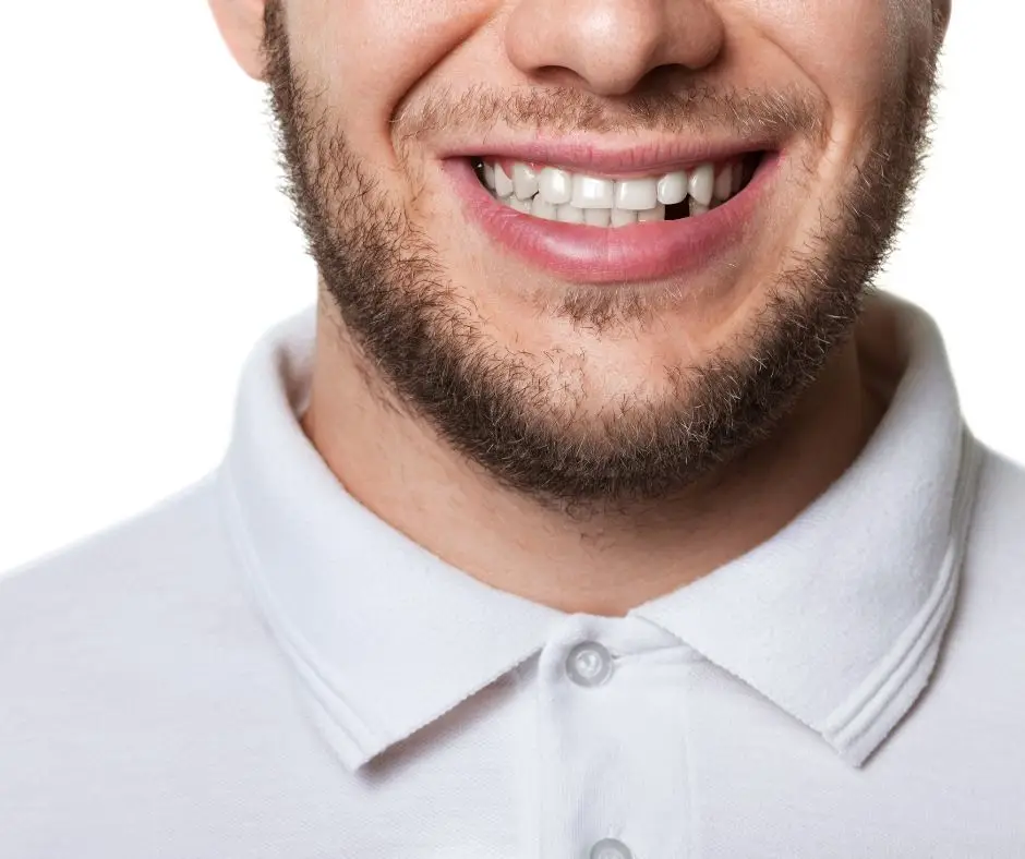 man missing tooth